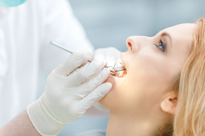 Endodoncija lečenje zuba, bele plombe, vadjenje zivca